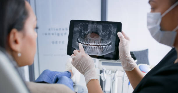 Licensed Dental Implants service in Katy, TX - Smile Center Dentistry